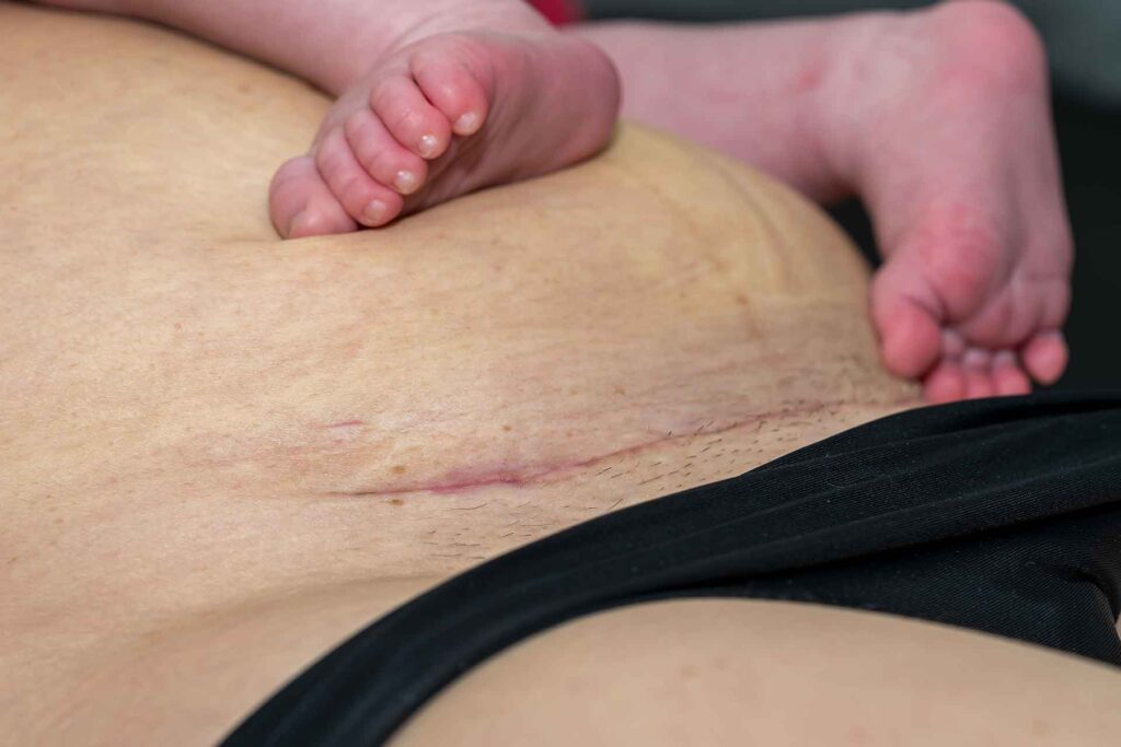 How do Scars affect me?