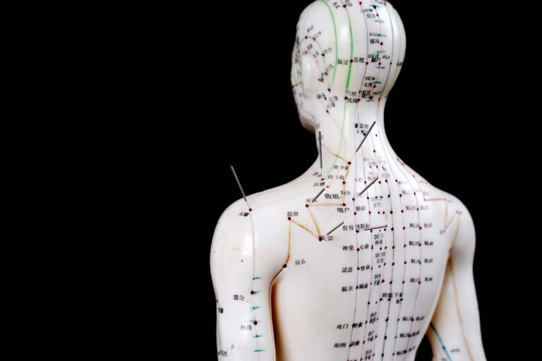 Supporting your mental health with Acupuncture